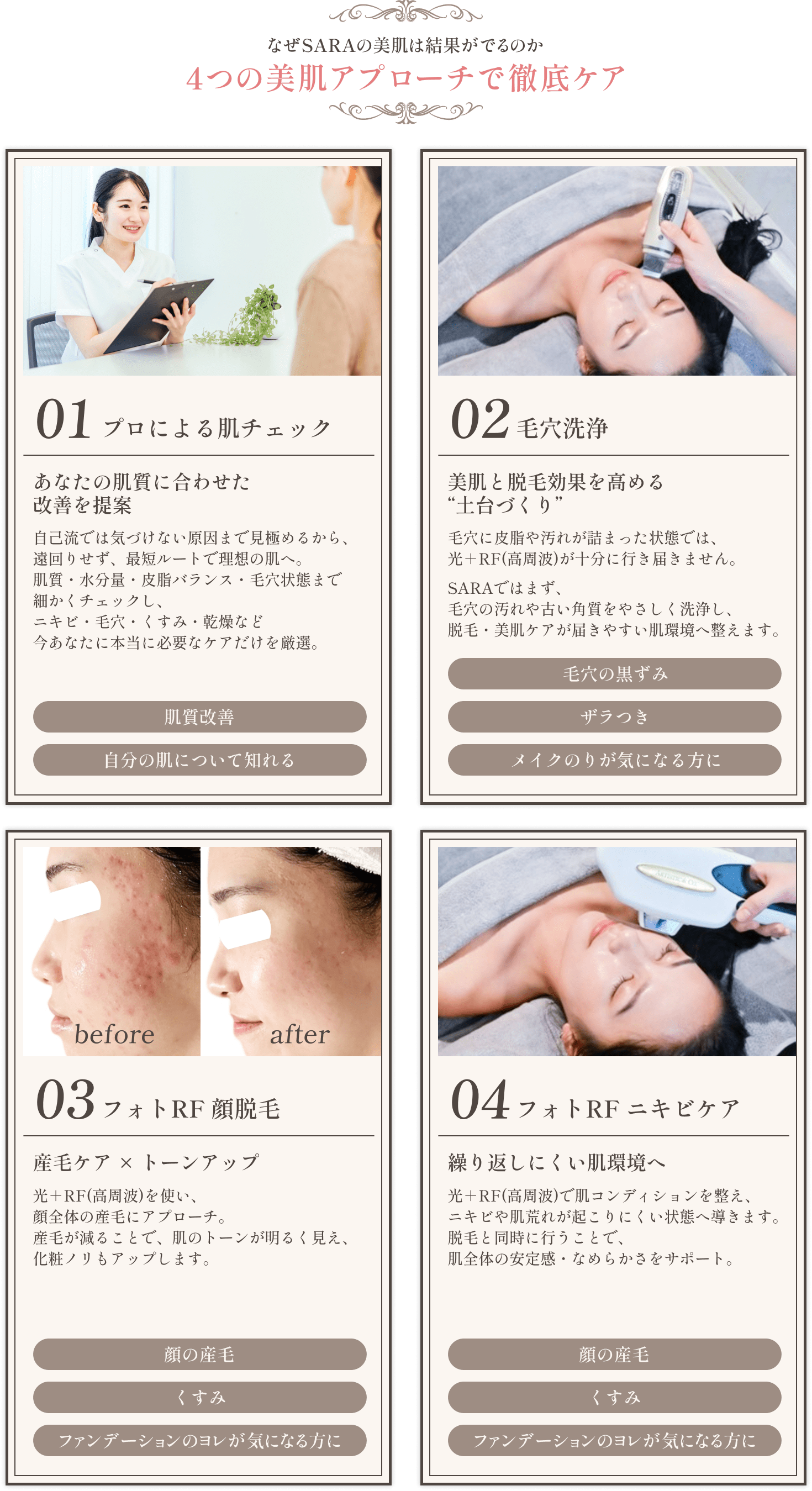 【なぜSARAの美肌は結果がでるのか】4つの美肌アプローチで徹底ケア 01.プロによる肌チェック 02.毛穴洗浄 03.フォトRF 顔脱毛 04.フォトRF ニキビケア